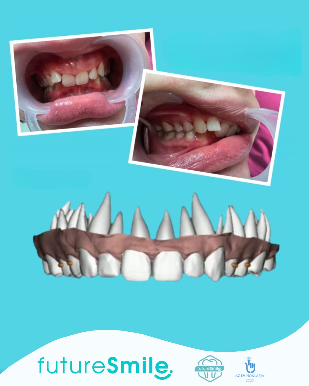 Előtte-utána: valódi eredmények